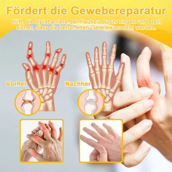 XRLXRL® Bienengift Schmerzstillende Knochenheilungscreme 👩‍⚕️LETZTER TAG 80 % RABATT