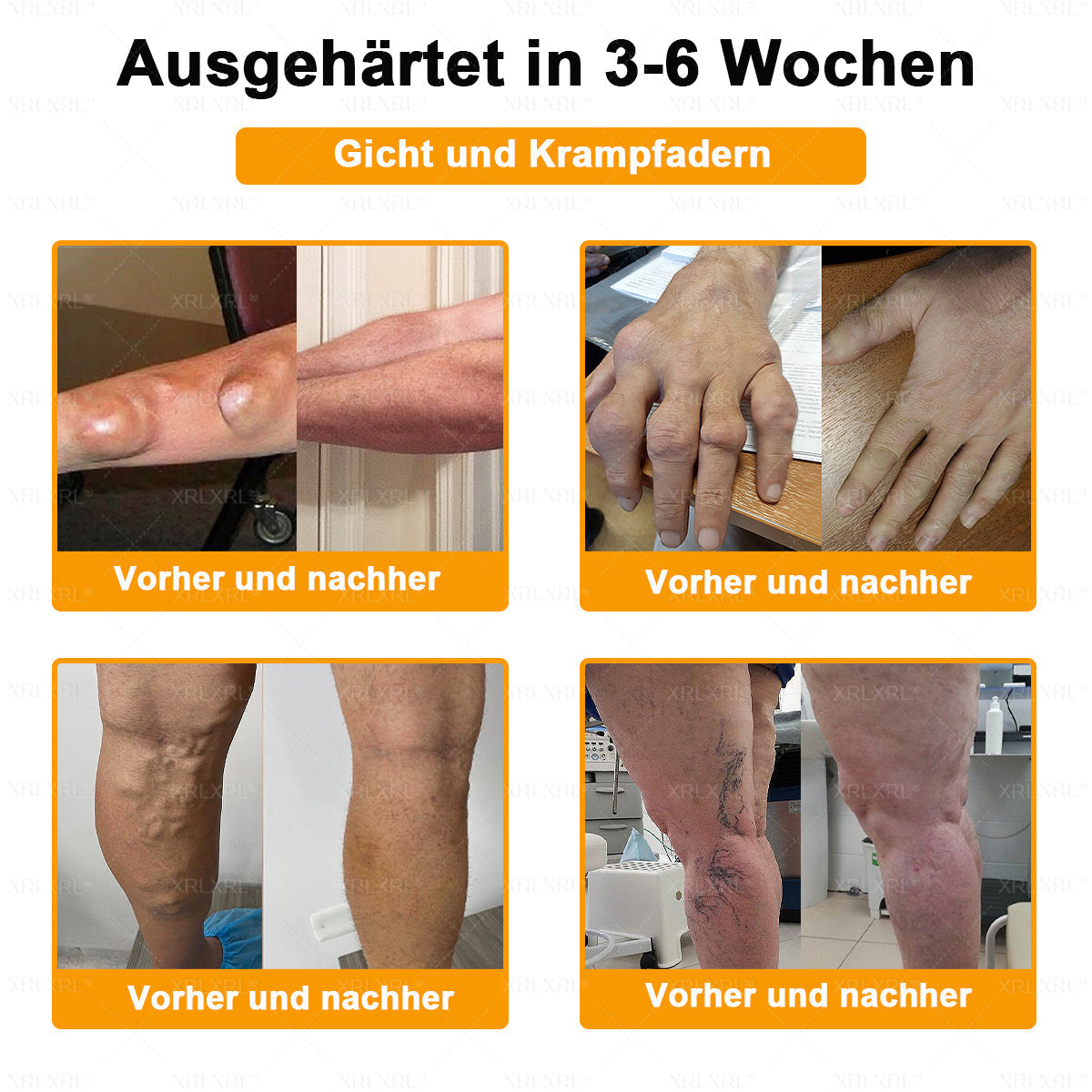 XRLXRL® Bienengift Schmerzstillende Knochenheilungscreme 👩‍⚕️LETZTER TAG 80 % RABATT
