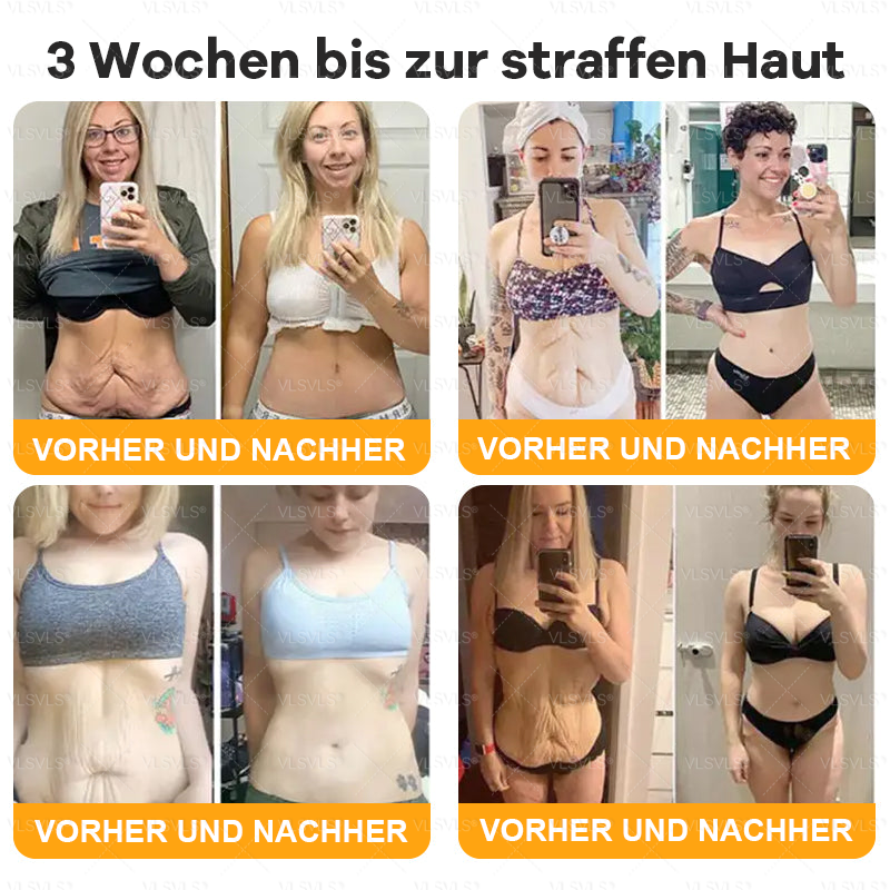 Hergestellt und versendet aus Deutschland  🎉VLSVLS® Bienengift Hautregenerationscreme 🔥 LETZTER TAG 80 % RABATT