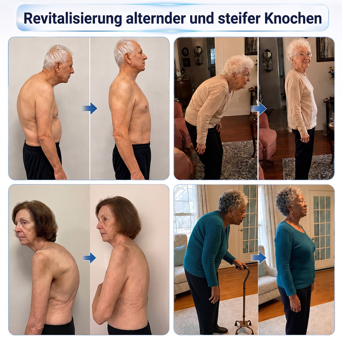 𝑿𝑹𝑳𝑿𝑹𝑳® 0,05 mm Mikronadel-Roller zur Unterstützung von Knochen & Gelenken 🧑‍⚕️🧑‍⚕️  (Für alle Erwachsenen, Frauen & Männer – Umfassende Pflege bei verschiedenen Gelenkbeschwerden)