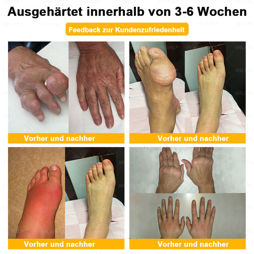 XRLXRL® Bienengift Schmerzstillende Knochenheilungscreme 👩‍⚕️LETZTER TAG 80 % RABATT