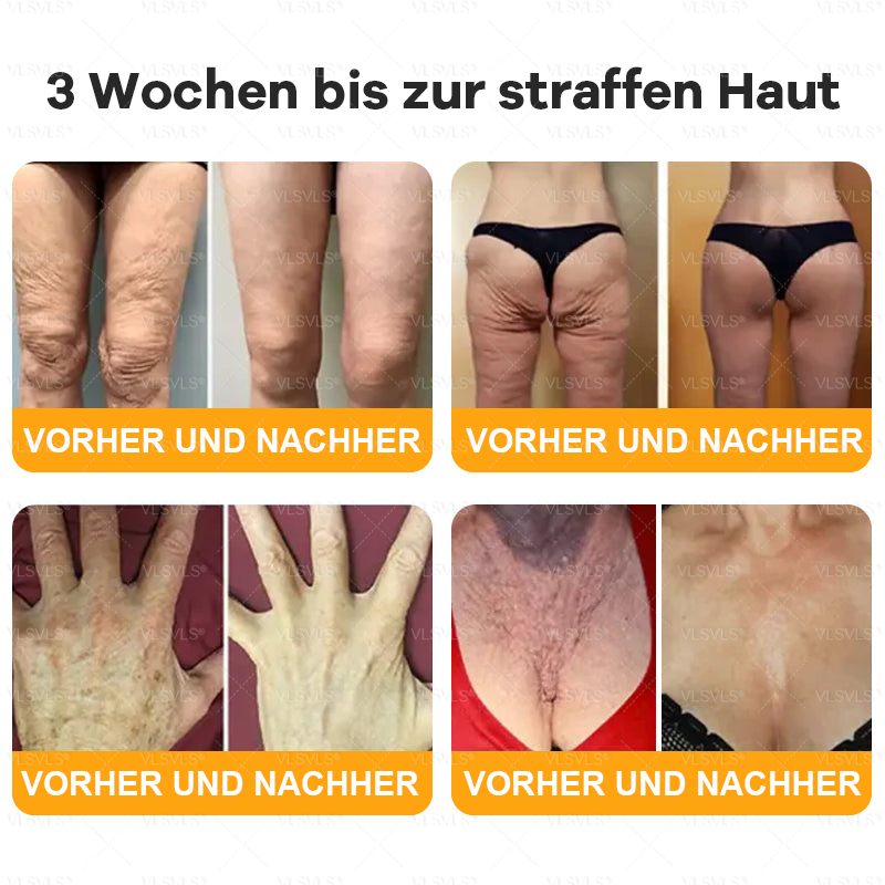 Hergestellt und versendet aus Deutschland  🎉VLSVLS® Bienengift Hautregenerationscreme 🔥 LETZTER TAG 80 % RABATT