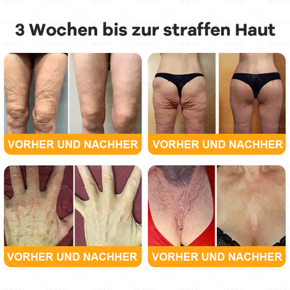 Hergestellt und versendet aus Deutschland  🎉VLSVLS® Bienengift Hautregenerationscreme 🔥 LETZTER TAG 80 % RABATT