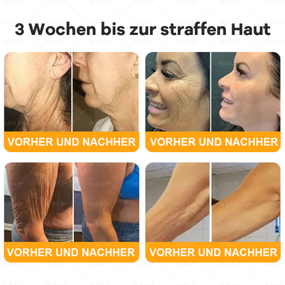 Hergestellt und versendet aus Deutschland  🎉VLSVLS® Bienengift Hautregenerationscreme 🔥 LETZTER TAG 80 % RABATT
