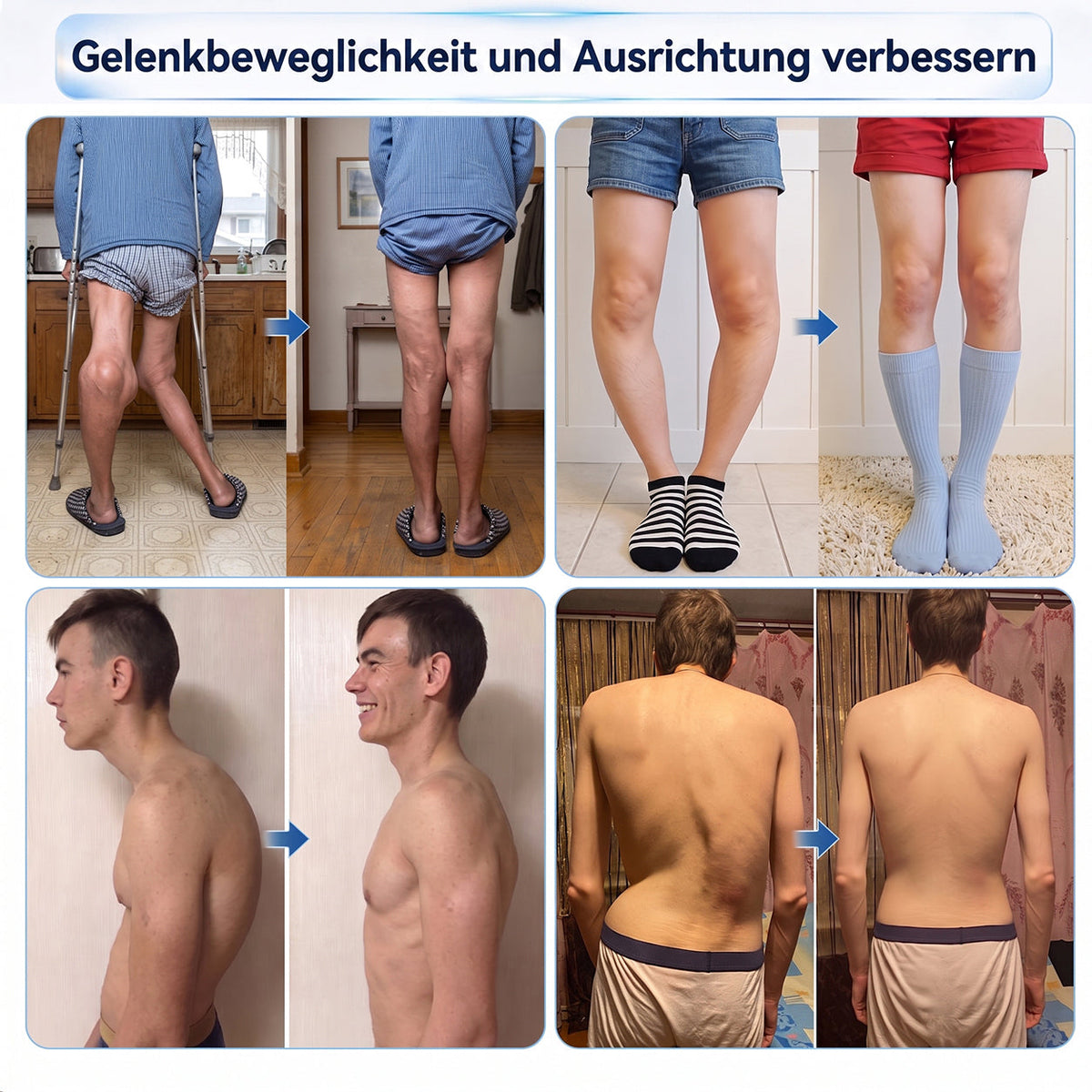 𝑿𝑹𝑳𝑿𝑹𝑳® 0,05 mm Mikronadel-Roller zur Unterstützung von Knochen & Gelenken 🧑‍⚕️🧑‍⚕️  (Für alle Erwachsenen, Frauen & Männer – Umfassende Pflege bei verschiedenen Gelenkbeschwerden)