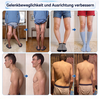 𝑿𝑹𝑳𝑿𝑹𝑳® 0,05 mm Mikronadel-Roller zur Unterstützung von Knochen & Gelenken 🧑‍⚕️🧑‍⚕️  (Für alle Erwachsenen, Frauen & Männer – Umfassende Pflege bei verschiedenen Gelenkbeschwerden)