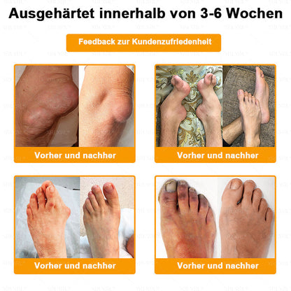 XRLXRL® Bienengift Schmerzstillende Knochenheilungscreme 👩‍⚕️LETZTER TAG 80 % RABATT