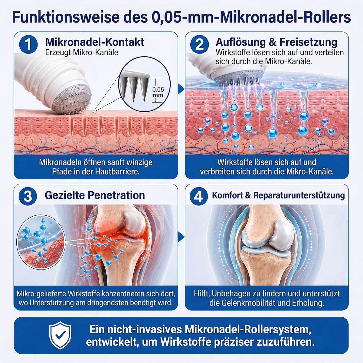 𝑿𝑹𝑳𝑿𝑹𝑳® 0,05 mm Mikronadel-Roller zur Unterstützung von Knochen & Gelenken 🧑‍⚕️🧑‍⚕️  (Für alle Erwachsenen, Frauen & Männer – Umfassende Pflege bei verschiedenen Gelenkbeschwerden)