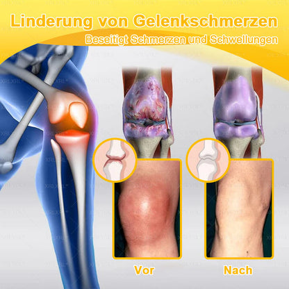 XRLXRL® Bienengift Schmerzstillende Knochenheilungscreme 👩‍⚕️LETZTER TAG 80 % RABATT