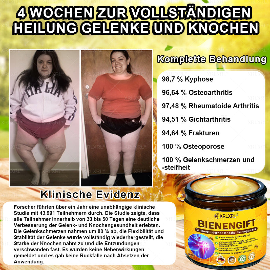 XRLXRL® Bienengift Schmerzstillende Knochenheilungscreme 👩‍⚕️LETZTER TAG 80 % RABATT