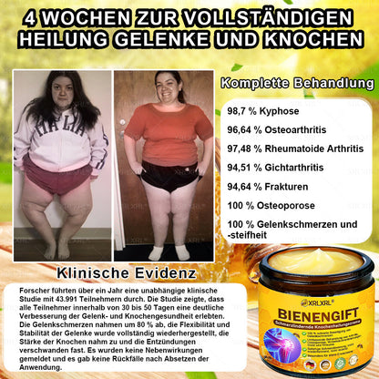 XRLXRL® Bienengift Schmerzstillende Knochenheilungscreme 👩‍⚕️LETZTER TAG 80 % RABATT